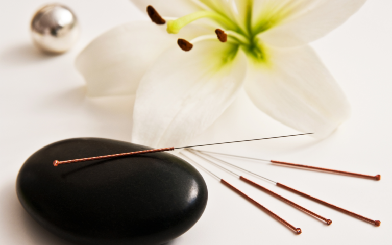 Akupunktur-Stile im Überblick
