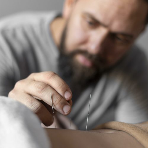 close-up-therapist-holding-acupuncture-needle
